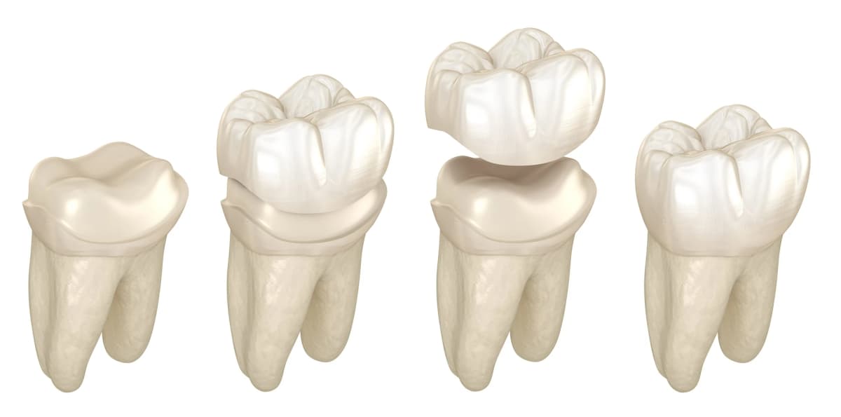 Restorative Dentistry