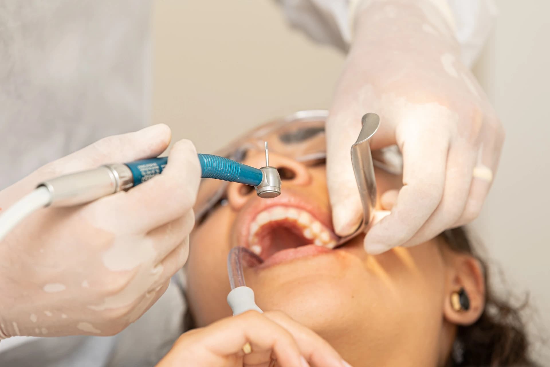 Surgical & Routine Extractions treatment at Maypole Dental Surgery