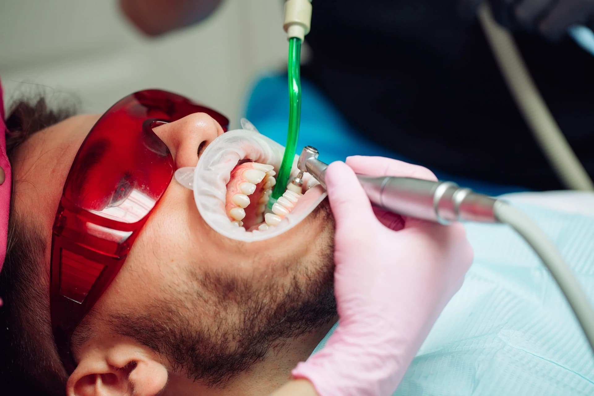 Hygiene treatment at Maypole Dental Surgery