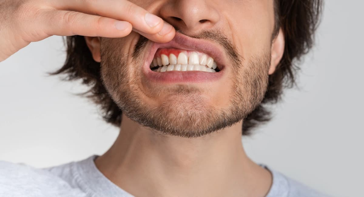 Periodontal Therapy